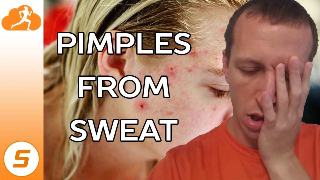 Pimples from Sweat While Working Out?