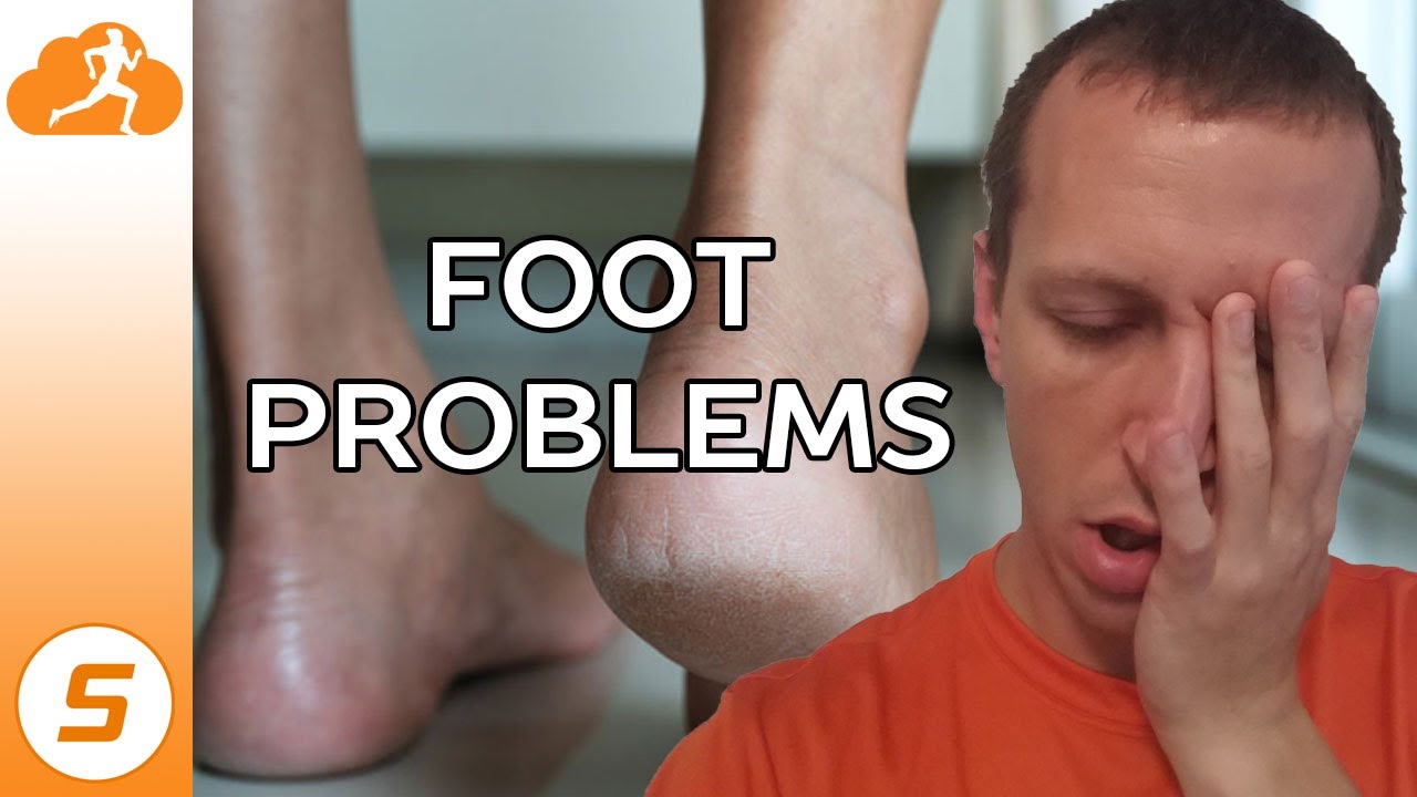 Can You Run with Plantar Fasciitis?