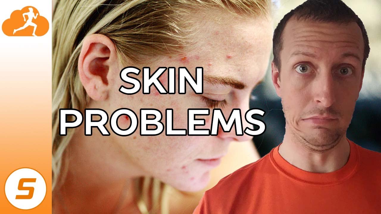 Can running cause skin problems?